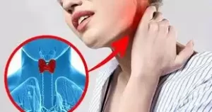 Bệnh lý tuyến giáp gây béo phì